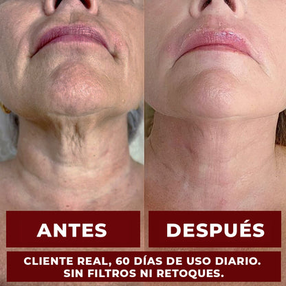 ZOOONE NAD+ Líquido